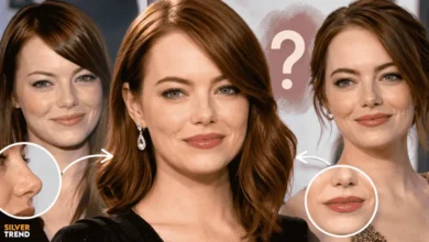 SilverTrend blog post about the Emma Stone Plastic Surgery.